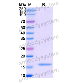 Recombinant Human CCL25/TECK, N-His