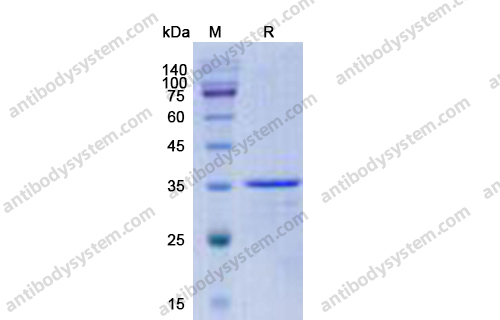 Recombinant Human CCL16/HCC-4, N-GST