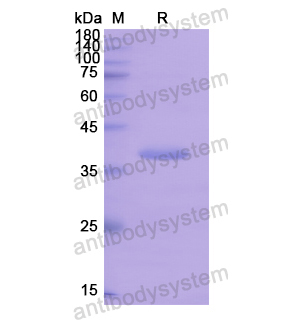 Recombinant Human OGG1, N-His