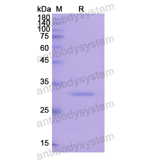 Recombinant Human PDK1/PDPK1, N-His