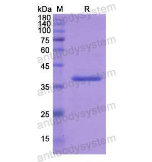 Recombinant Human ADAM12, N-His