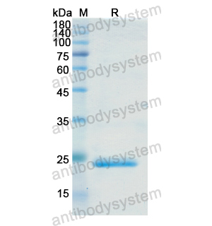 Recombinant Human TREH, N-His