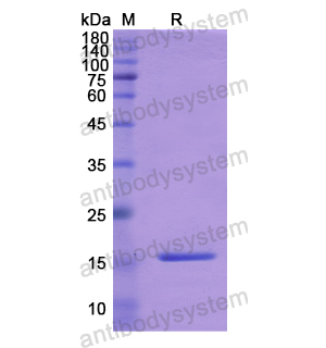Recombinant Human TGFB1I1, N-His