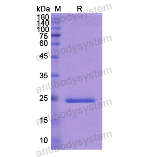 Recombinant Human ADCY6, N-His