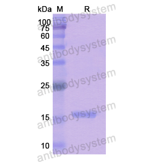 Recombinant Human FIBP, N-His
