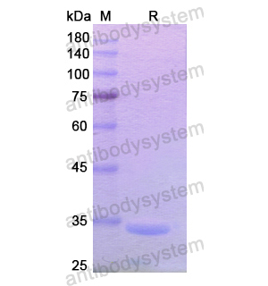 Recombinant Human SUV39H1, N-His