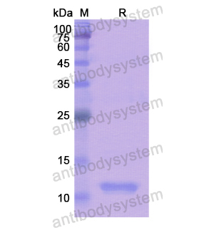 Recombinant Human LAMTOR5, N-His