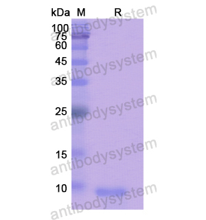 Recombinant Human HCRT, N-His