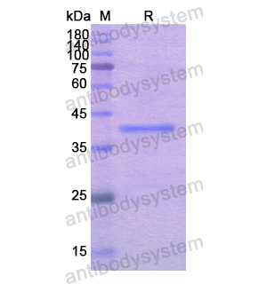 Recombinant Human NARS1, N-His