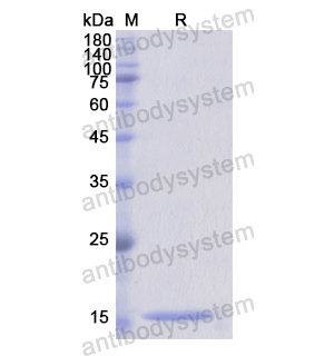 Recombinant Human CD5L, N-His