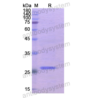 Recombinant Human KLK8, N-His