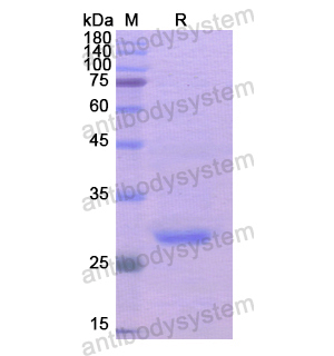 Recombinant Human ADCY3, N-His