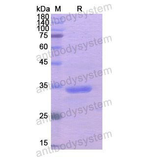 Recombinant Human PPL, N-His