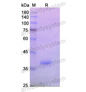 Recombinant Human CD232/PLXNC1, N-His