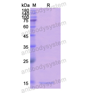 Recombinant Human CUBN, N-His