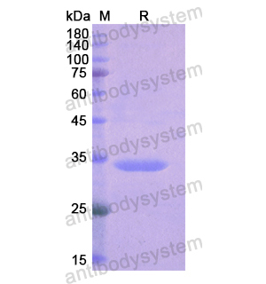 Recombinant Human NPHS1, N-His