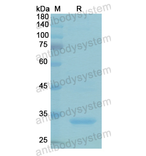 Recombinant Human ADCY9, N-His
