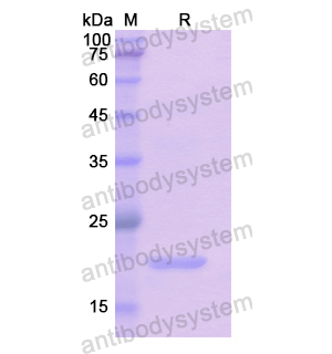 Recombinant Human GREM1, N-His