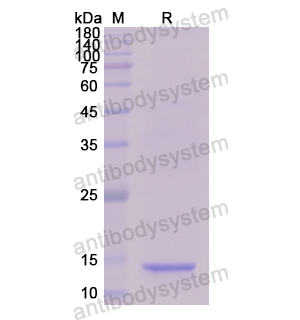 Recombinant Human TLR5, N-His