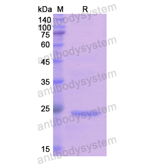 Recombinant Human DIAPH1, N-His