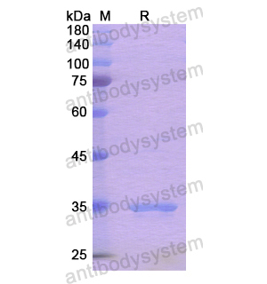 Recombinant Human JAK2, N-His