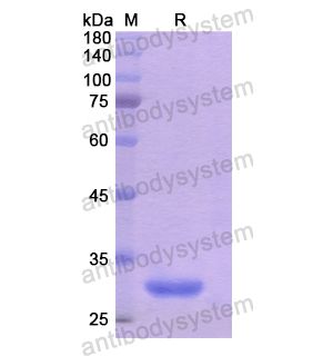 Recombinant Human SMPD2, N-His
