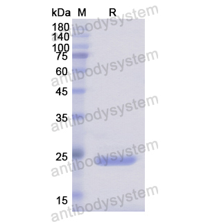 Recombinant Human SLIT1, N-His