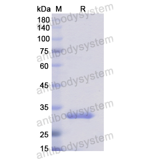 Recombinant Human AOC2, N-His