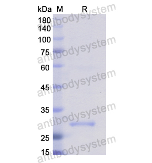 Recombinant Human ROCK2, N-His