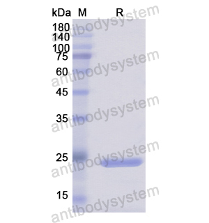 Recombinant Human DUSP11, N-His