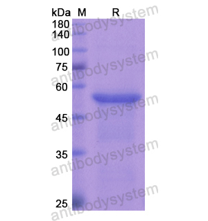 Recombinant Human CILP, N-GST
