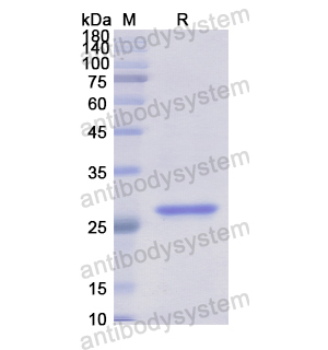 Recombinant Human ALOX12B, N-His