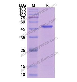 Recombinant Human ERN1, N-His