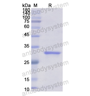 Recombinant Human GPC4, N-His