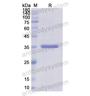 Recombinant Human EED, N-His