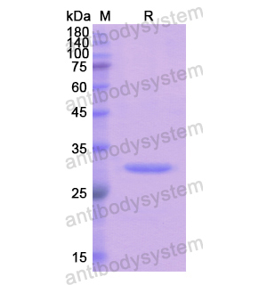 Recombinant Human FCN3, N-His