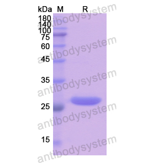 Recombinant Human NUP155, N-His