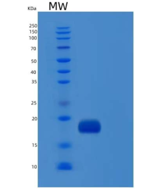 Recombinant Human IL1F10 / IL-38 Protein (His tag)