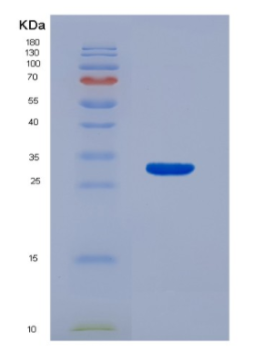Recombinant Interleukin 22 Receptor Alpha 2 (IL22Ra2)
