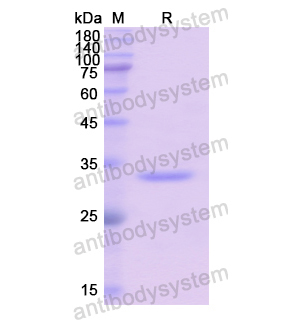 Recombinant Human BCAR3, N-His