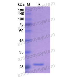 Recombinant Human RPP40, N-His