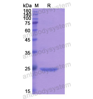 Recombinant Human CNMD, N-His