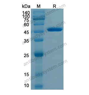 Recombinant Human IDH1, N-His