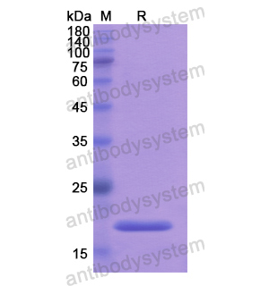 Recombinant Human ATRN, N-His