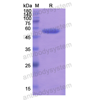 Recombinant Human ALDH1L1, N-His