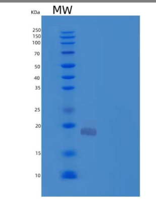 Recombinant Human Hemoglobin Subunit ζ/HBAZ Protein(N-6His)