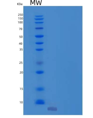 Recombinant Human NIP7/KD93 Protein(N-6His)