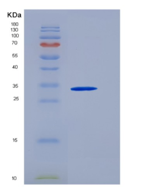 Recombinant Human Thioredoxin Domain-Containing Protein 15/TXNDC15 Protein(C-6His)