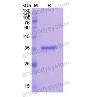 Recombinant Human RGS9, N-His