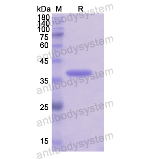 Recombinant Human KRT33A, N-His